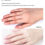 Paraffin dark knuckles manicure