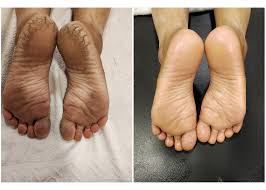 ADD-ON FOR PEDICURE AND MANICURE: Heel peel